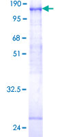 12.5% SDS-PAGE Stained with Coomassie Blue.